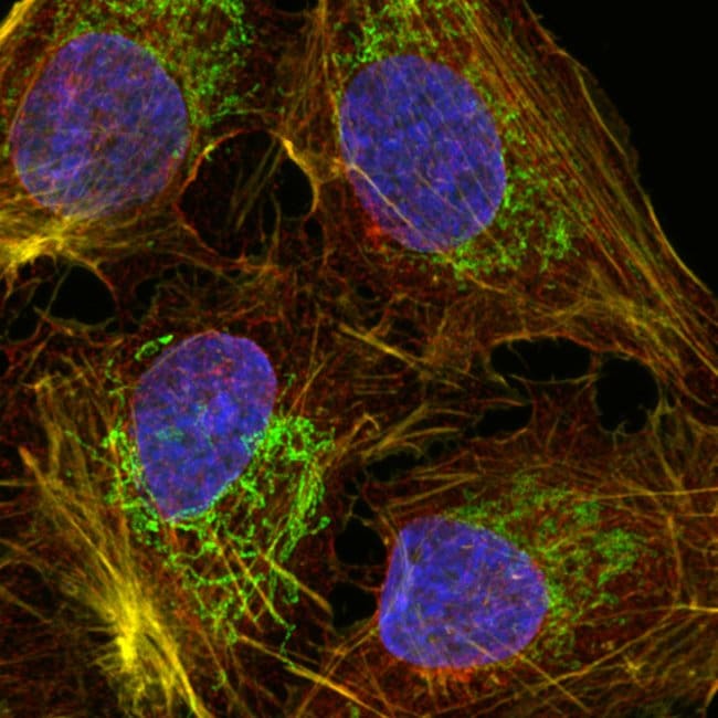 ProLong™ Glass Antifade Mountant